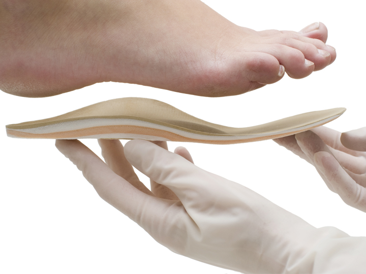 การทำแผ่นรองเท้าเฉพาะบุคคล (Custom-made Insoles)